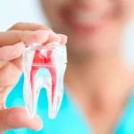 Лечение пульпита зуба - Стоматология в Минске Easydentist | Лечение, протезирование зубов | Полечить зубы, вставить зубы Стоматология Easydentist