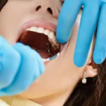 Парестезия в стоматологии - Стоматология в Минске Easydentist | Лечение, протезирование зубов | Полечить зубы, вставить зубы Стоматология Easydentist