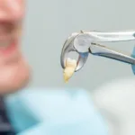 Удаление многокорневых зубов - Стоматология в Минске Easydentist | Лечение, протезирование зубов | Полечить зубы, вставить зубы Стоматология Easydentist
