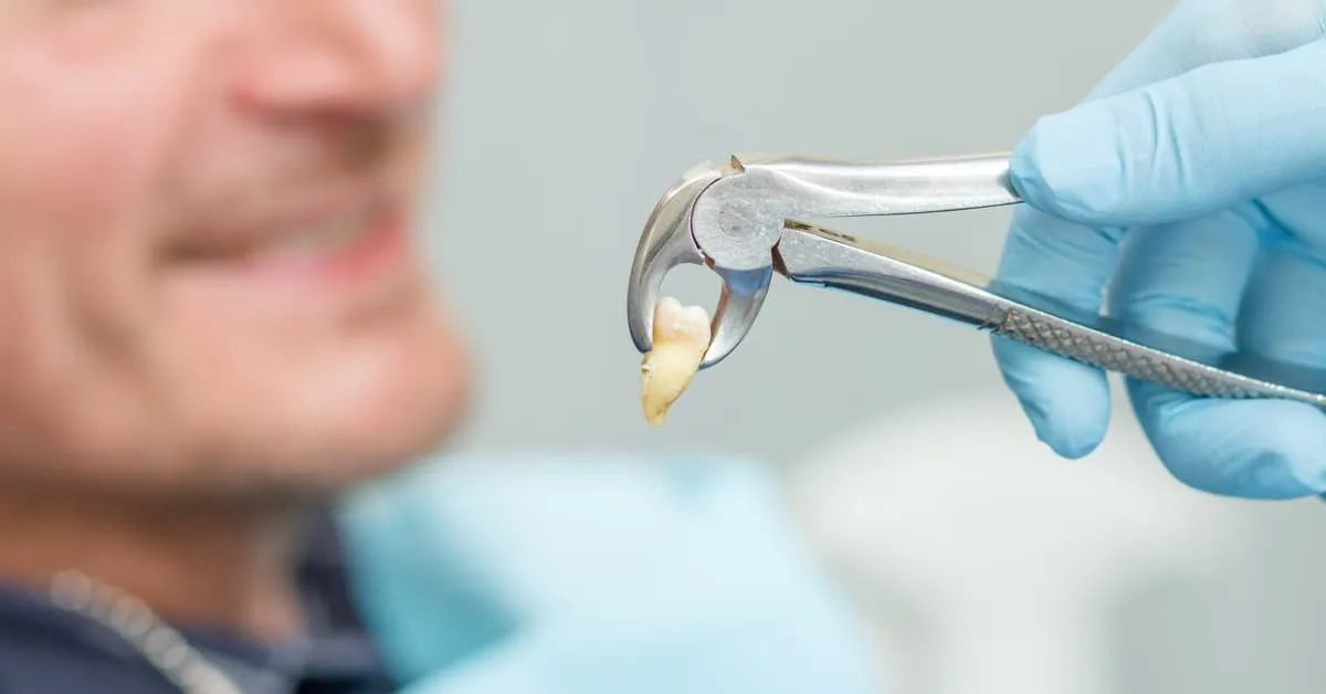 Удаление многокорневых зубов - Стоматология в Минске Easydentist | Лечение, протезирование зубов | Полечить зубы, вставить зубы Стоматология Easydentist