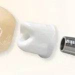 Абатмент Ti-base: разновидности и показания - Стоматология в Минске Easydentist | Лечение, протезирование зубов | Полечить зубы, вставить зубы Стоматология Easydentist