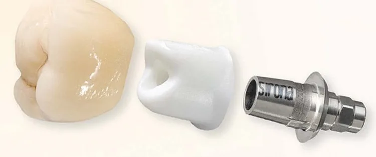 Абатмент Ti-base: разновидности и показания - Стоматология в Минске Easydentist | Лечение, протезирование зубов | Полечить зубы, вставить зубы Стоматология Easydentist