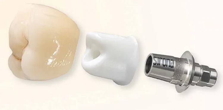 Абатмент Ti-base: разновидности и показания - Стоматология в Минске Easydentist | Лечение, протезирование зубов | Полечить зубы, вставить зубы Стоматология Easydentist