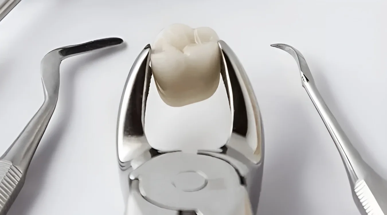 Протезирование зубов без имплантов - Стоматология в Минске Easydentist | Лечение, протезирование зубов | Полечить зубы, вставить зубы Стоматология Easydentist