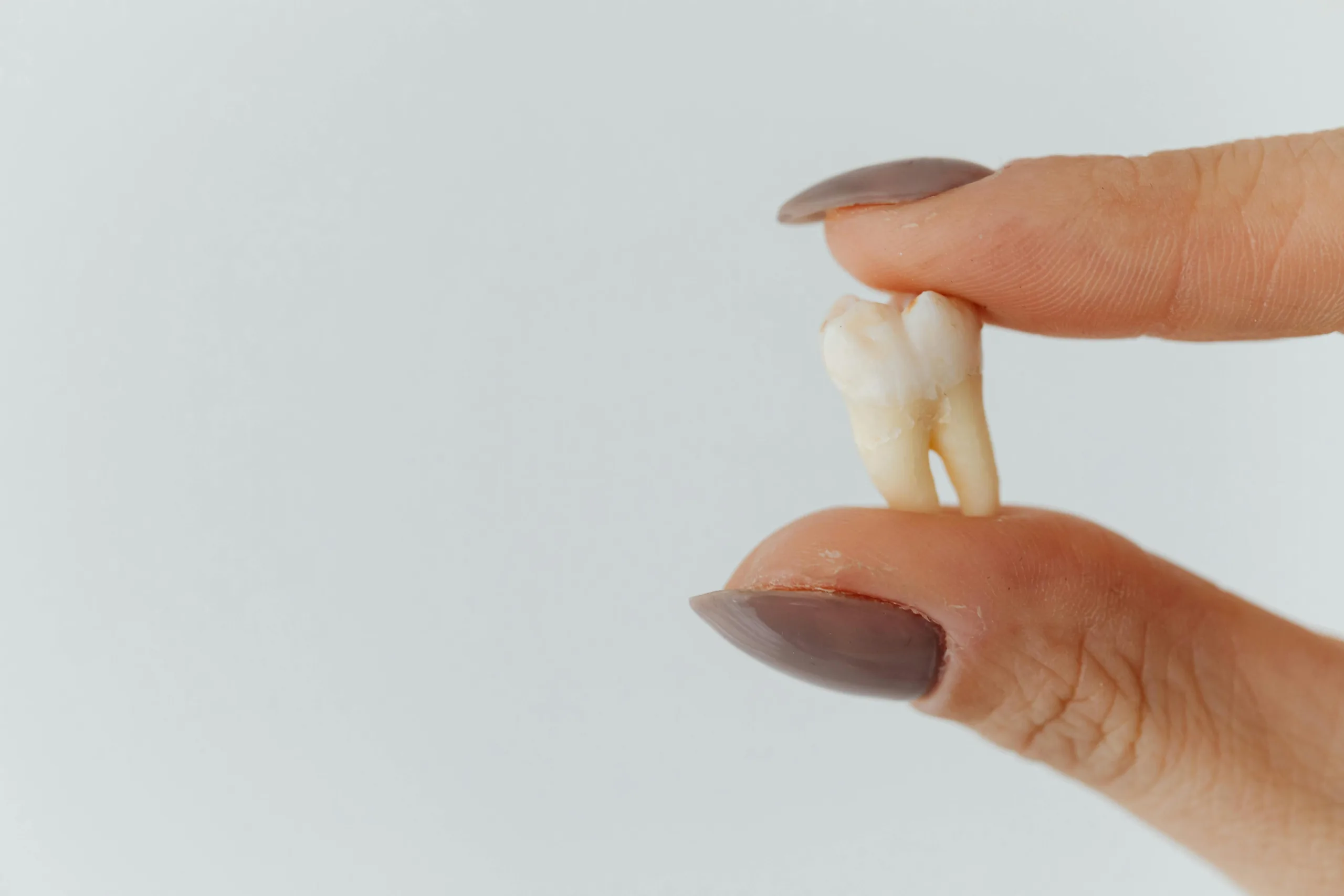 Почему болит зуб при явном отсутствии кариеса? - Стоматология в Минске Easydentist | Лечение, протезирование зубов | Полечить зубы, вставить зубы Стоматология Easydentist