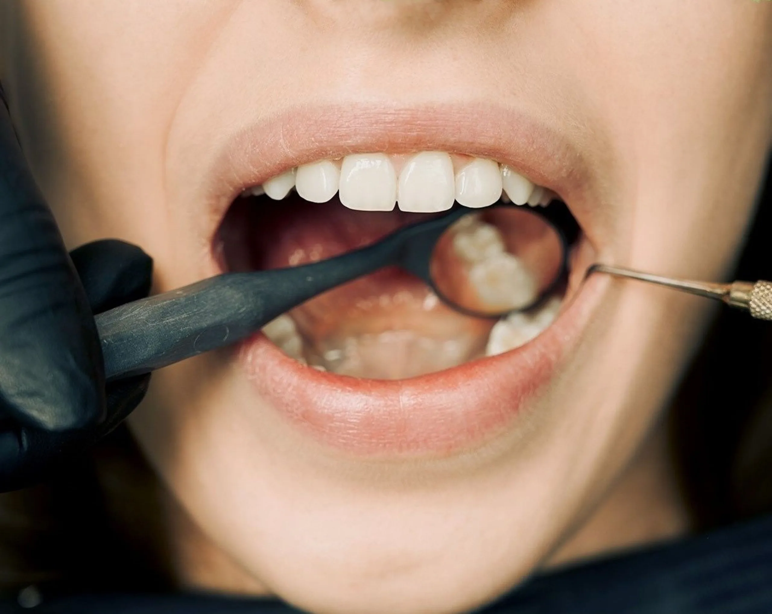Главная - Стоматология в Минске Easydentist | Лечение, протезирование зубов | Полечить зубы, вставить зубы Стоматология Easydentist